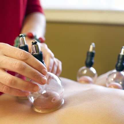 cupping